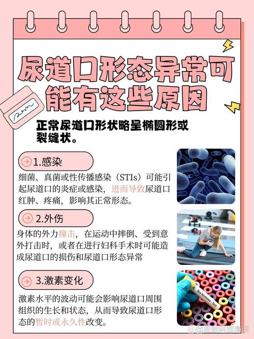 老湿机影院一分钟免费观看x的相关介绍