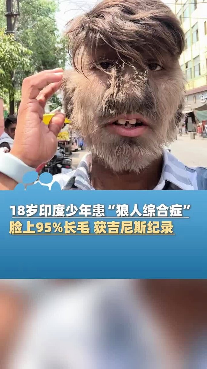 视频免费下载app下载的相关介绍